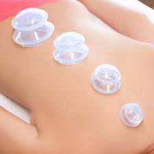cupping3.jpg
